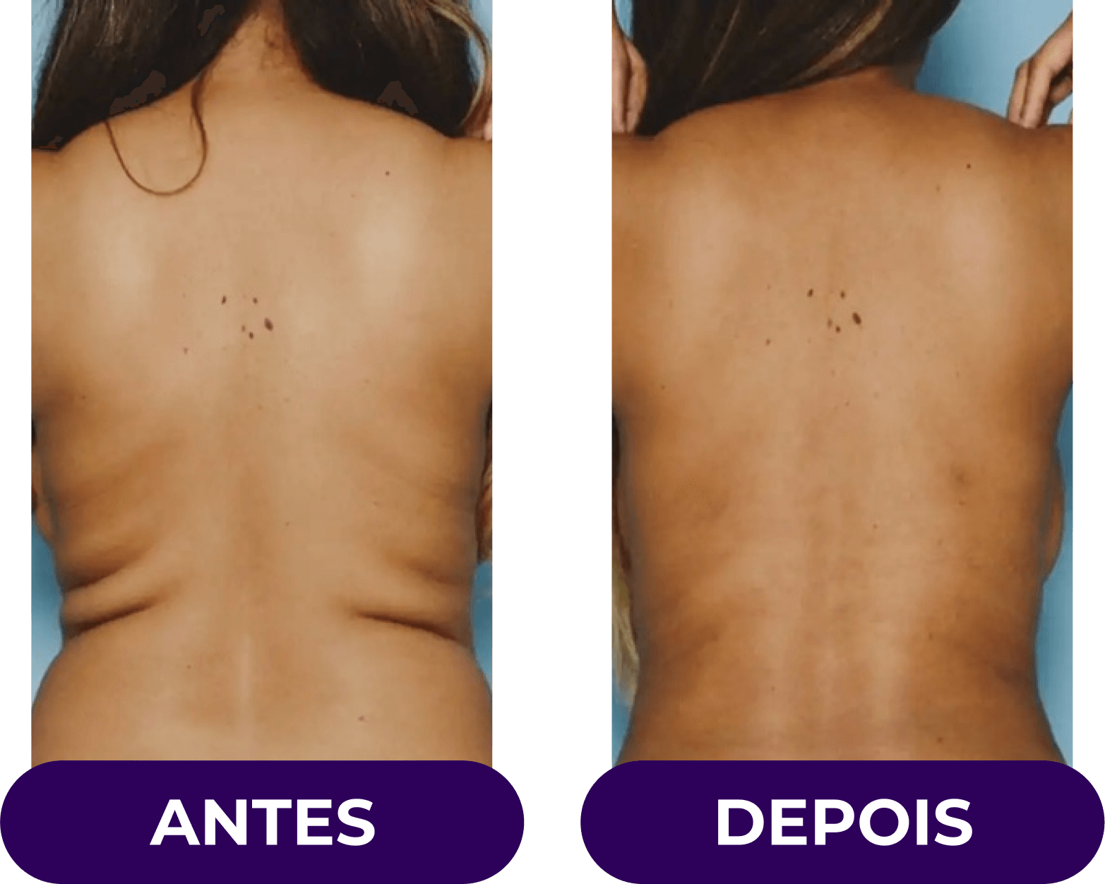 antes-e-depois02v2.png