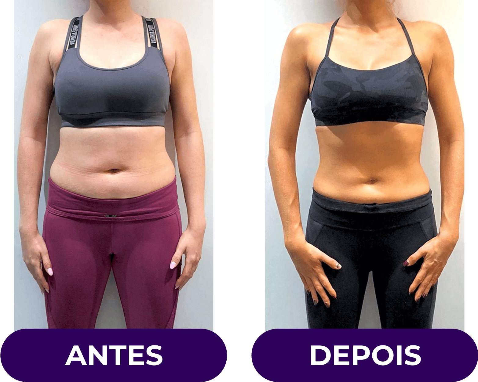 antes-e-depois04v2.png
