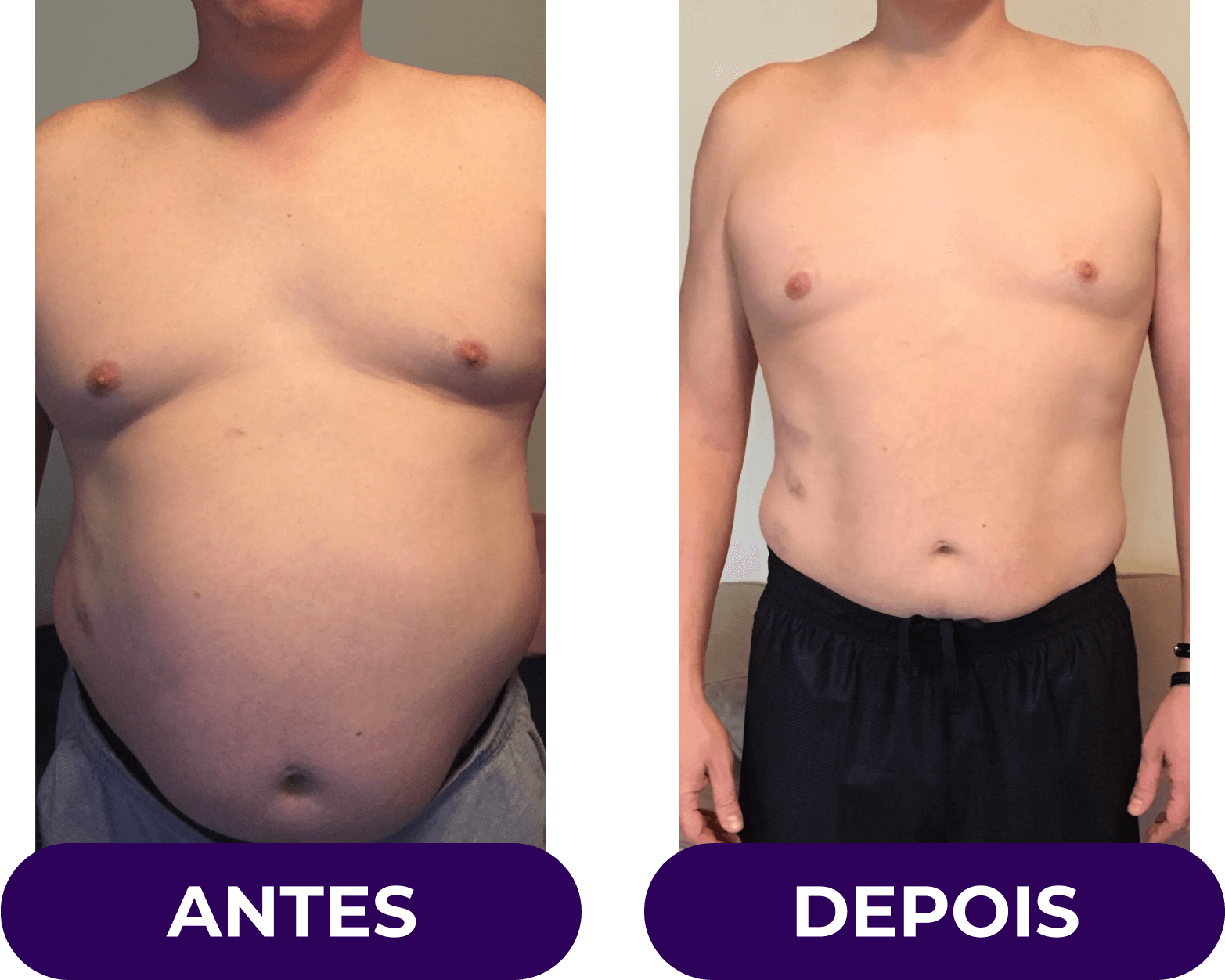 antes-e-depois05v2-1.png