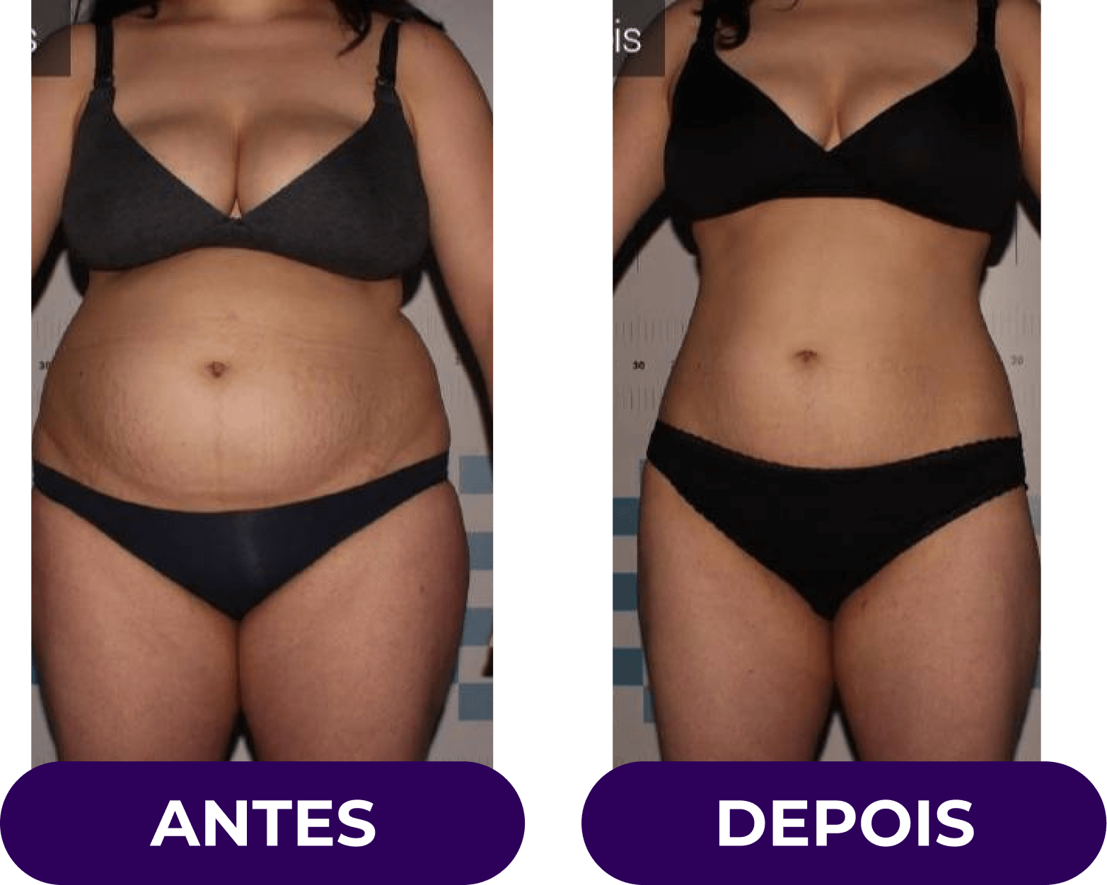 antes-e-depois09v2.png